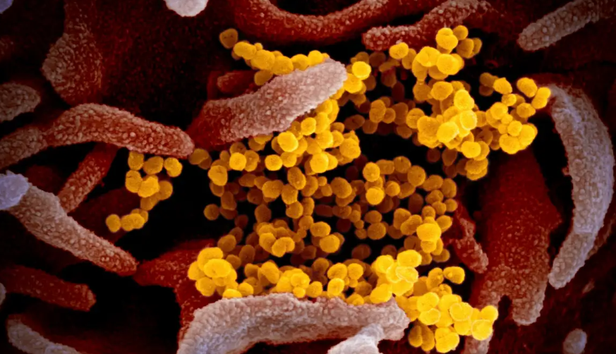 Human metapneumovirus cases surge in China: All about the virus that's triggering an epidemic like situation